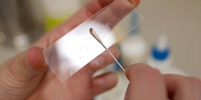 grattage de la peau pour les parasites