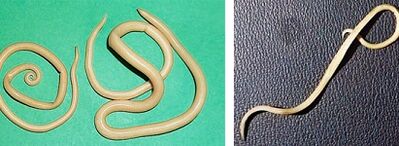 quels parasites une personne peut avoir